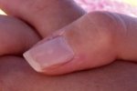 finger-nail