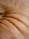 Skin Care Information for Wrinkles